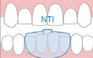 TMJ and Teeth Grinding Treatment
