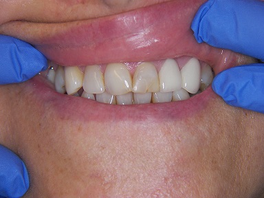 smile Gallery new orleans dentist