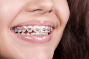 Orthodontic Web Design