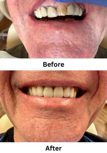 Before and After New Orleans Dentist